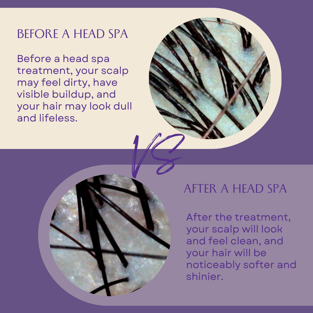 pictures before and after of the scalp with the dermascope